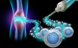 Stem Cell Therapy